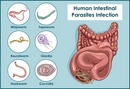 Parasites and the Gut
